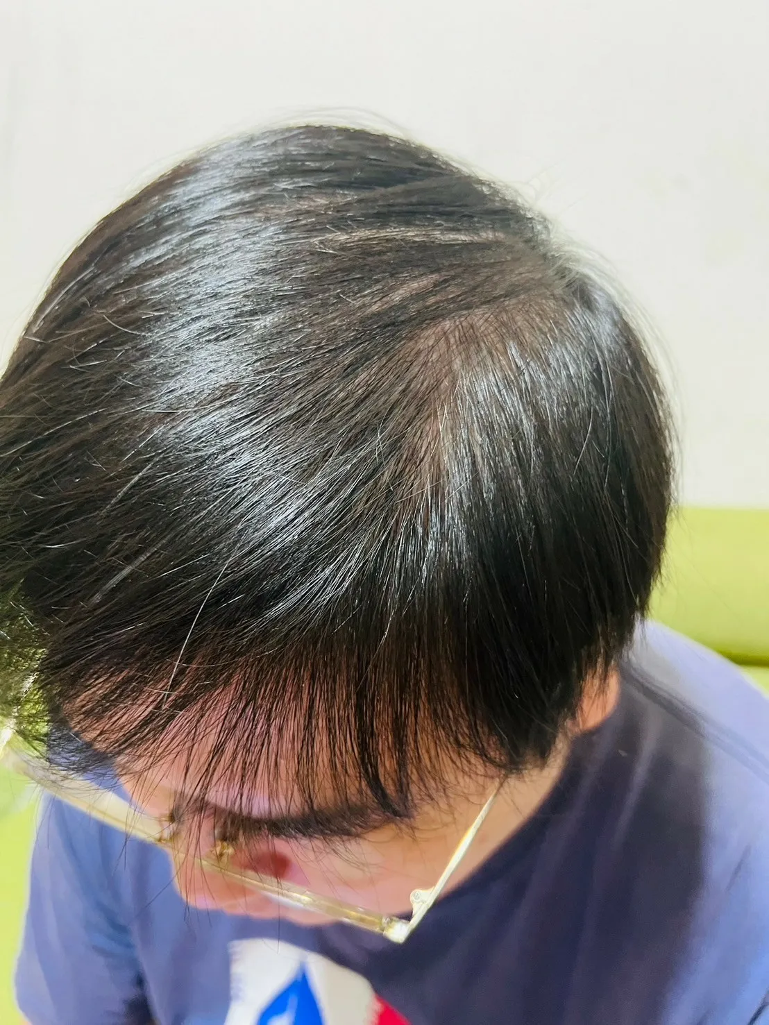 LINE_ALBUM_[康定酵素極萃滋養洗髮乳］擺脫敏感乾癢問題 24小時滋養保濕_241104_15.jpg
