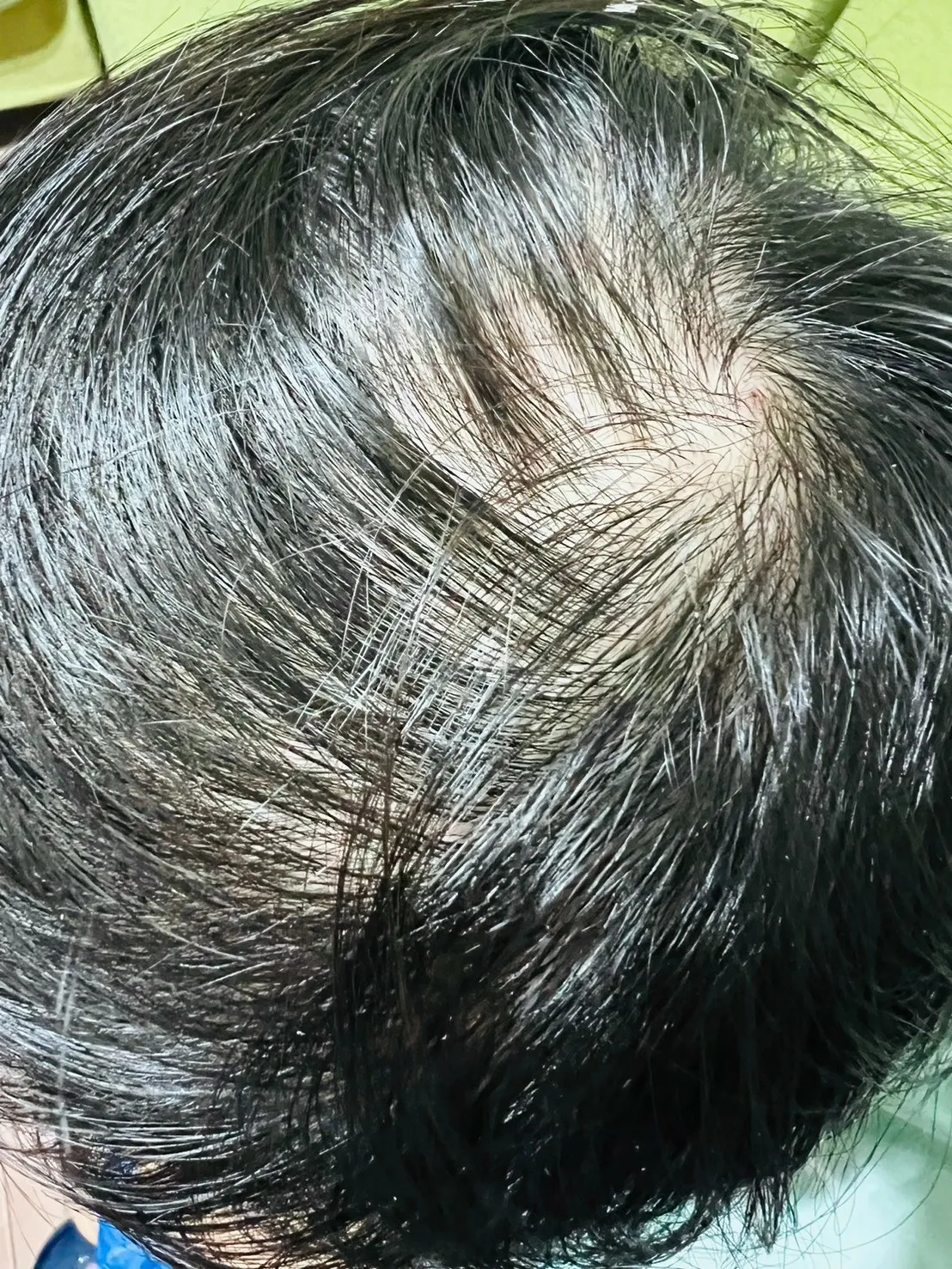 LINE_ALBUM_[康定酵素極萃滋養洗髮乳］擺脫敏感乾癢問題 24小時滋養保濕_241104_2.jpg