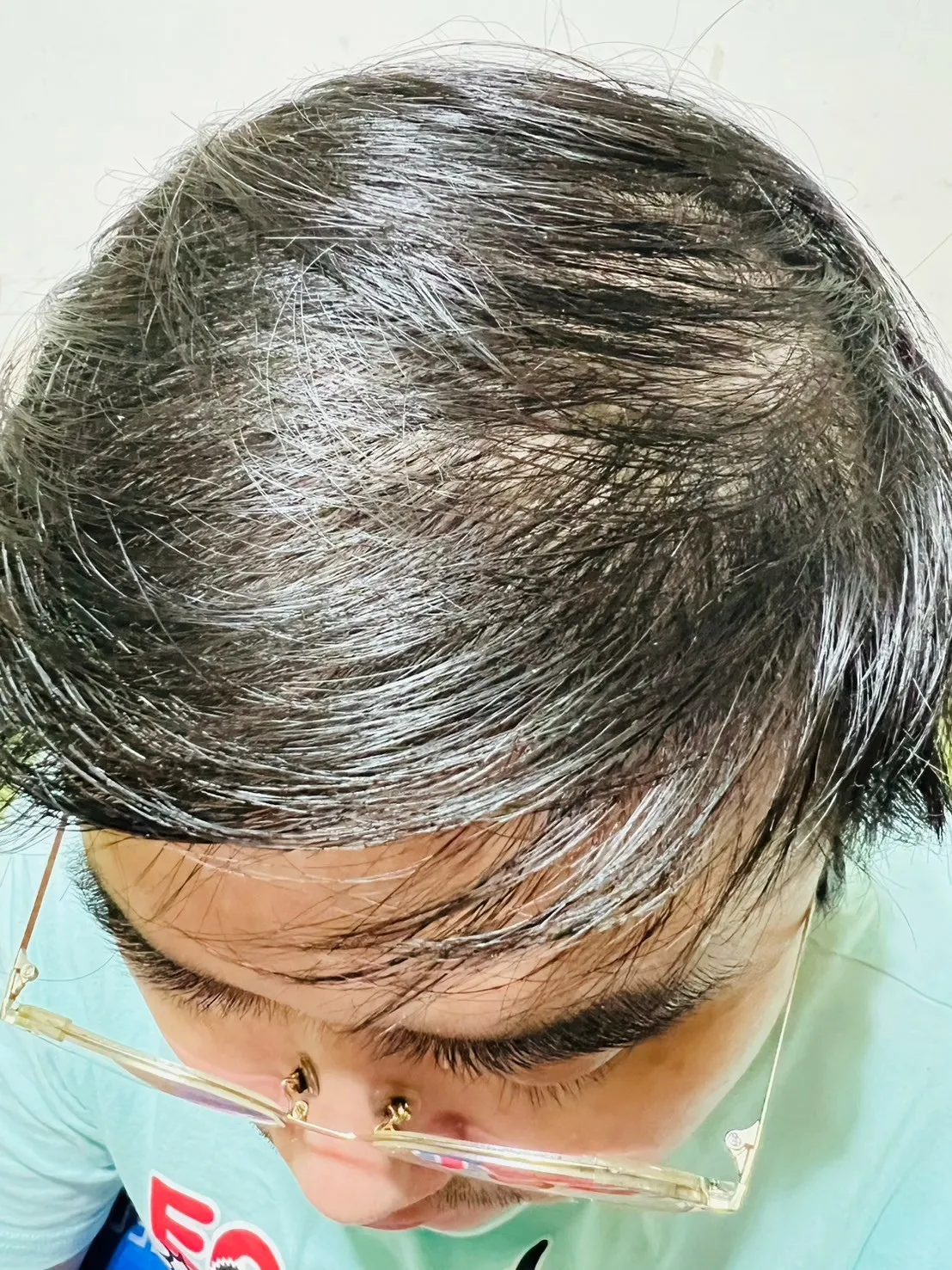 LINE_ALBUM_[康定酵素極萃滋養洗髮乳］擺脫敏感乾癢問題 24小時滋養保濕_241104_1.jpg